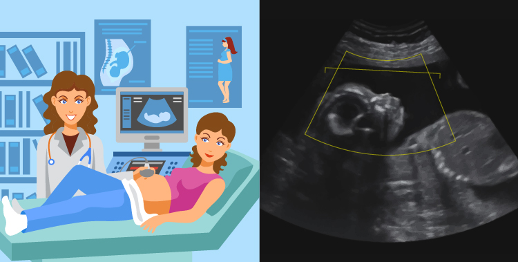 Fundación_Carlos_Slim-Ultrasonidos